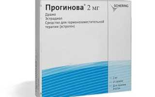 Прогинова