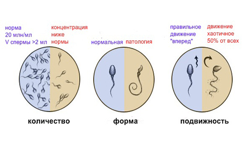 kachestva spermy po spermogramme