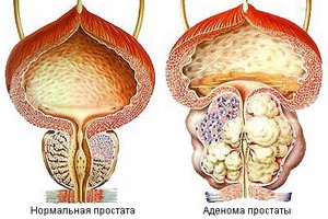 Норма и патология